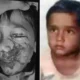 कुत्ते ने मासूम का जबड़ा नोंचा, दांत भी खा गए,भोपाल में 6 साल के बच्चे पर हमला, जबड़े पर 20 टांके आए.. 61 कुत्ते ने मासूम का जबड़ा नोंचा, दांत भी खा गए,भोपाल में 6 साल के बच्चे पर हमला, जबड़े पर 20 टांके आए.. October 7, 2026