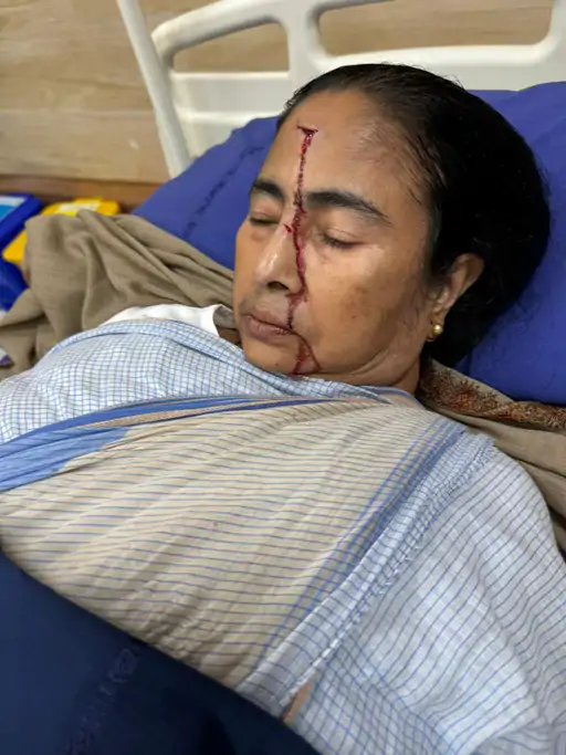 हेलिकॉप्टर में चढ़ने के दौरान ममता लड़खड़ाकर गिरीं,दुर्गापुर में हादसा; पिछले महीने घर में गिरने से माथे पर चोट लगी थी.. 40 हेलिकॉप्टर में चढ़ने के दौरान ममता लड़खड़ाकर गिरीं,दुर्गापुर में हादसा; पिछले महीने घर में गिरने से माथे पर चोट लगी थी.. October 20, 2026