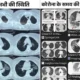 MP में कोरोना वायरस जैसा संक्रमण, स्ट्रेन में बदलाव,4 दिन के बुखार में लंग्स में 40% इन्फेक्शन, दो सीटी स्कैन इमेज से समझें कोराना और वर्तमान स्थिति October 18, 2026